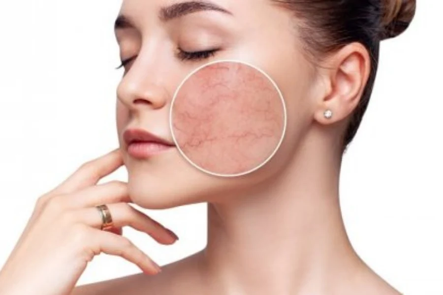 Da Nhạy Cảm Là Gì