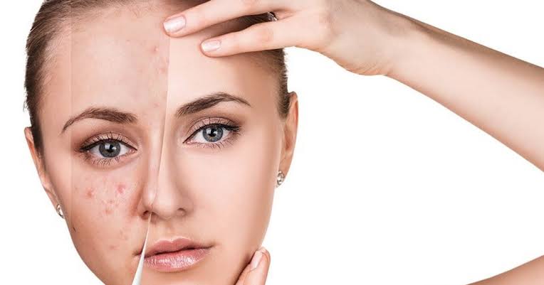 Skincare Buổi Tối